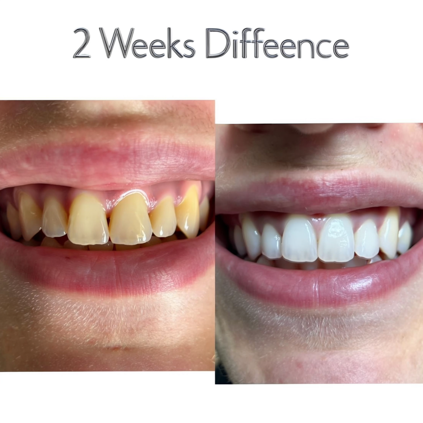 Whiter, Cleaner, Healthier Teeth-In Just 30 Seconds A Day!