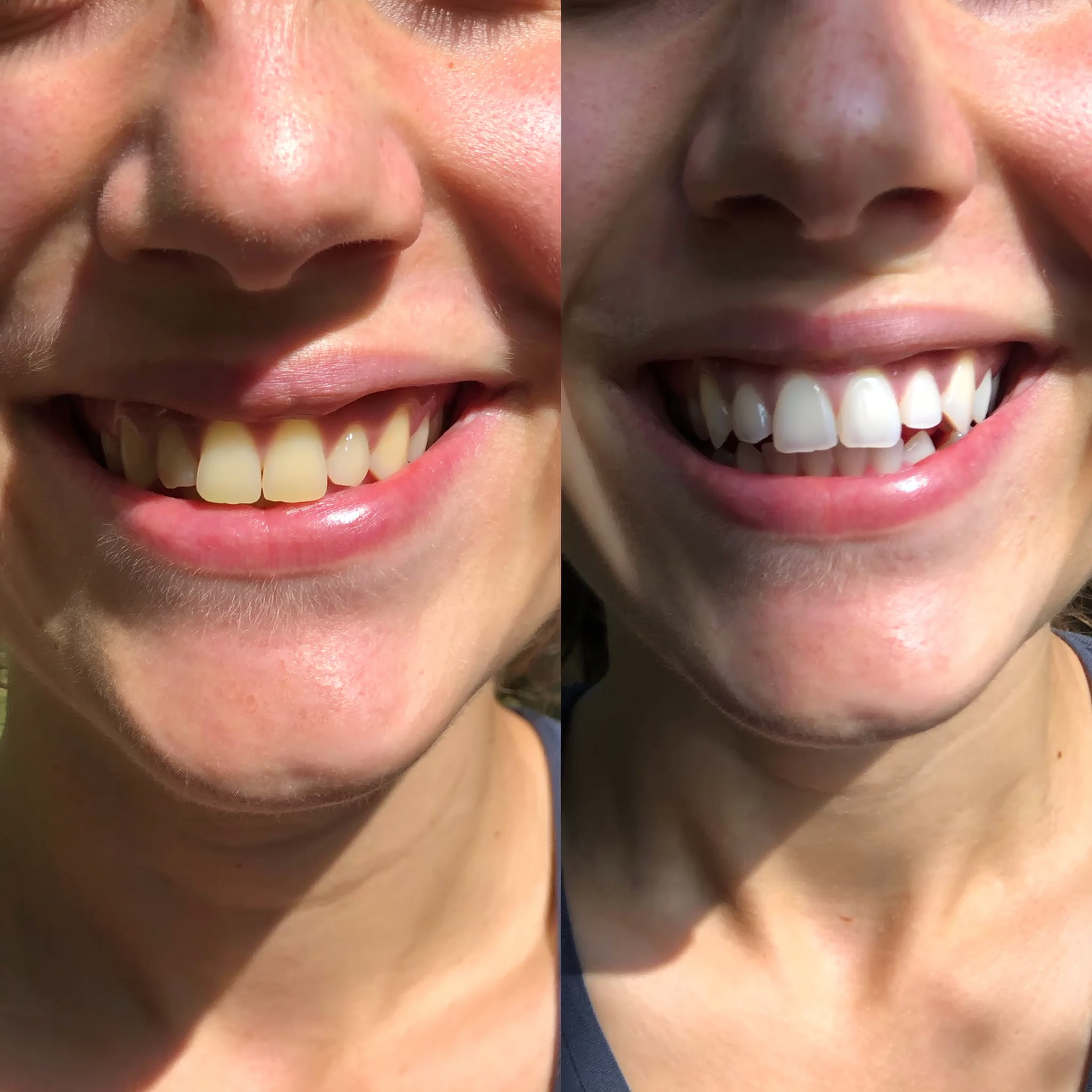 Whiter, Cleaner, Healthier Teeth-In Just 30 Seconds A Day!